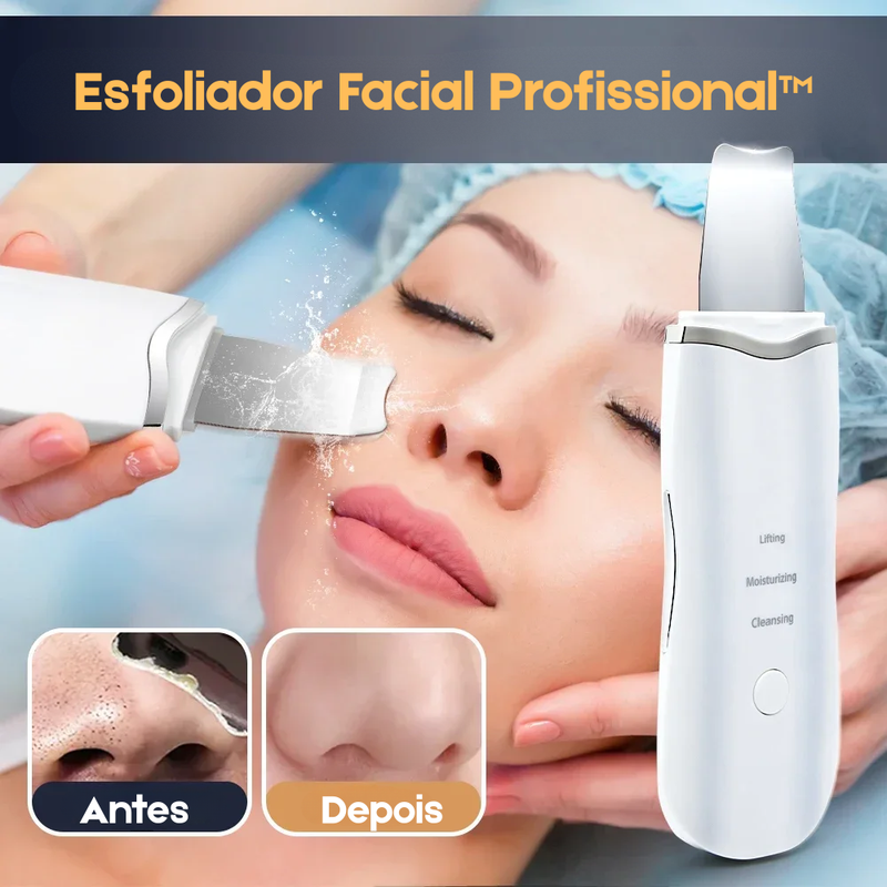 Esfoliador Facial Profissional™ com Tecnologia Iônica Removedor de Cravos